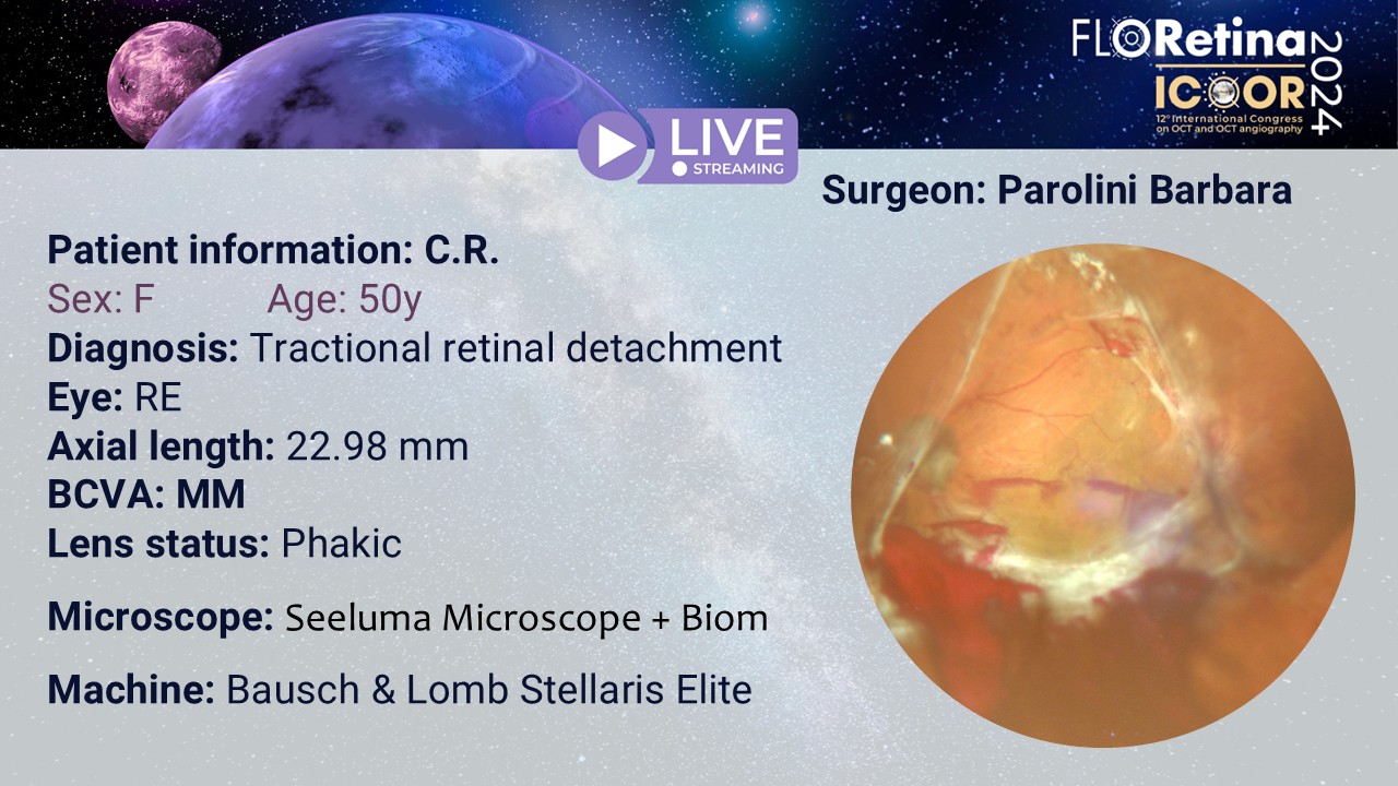 Tractional retinal detachment