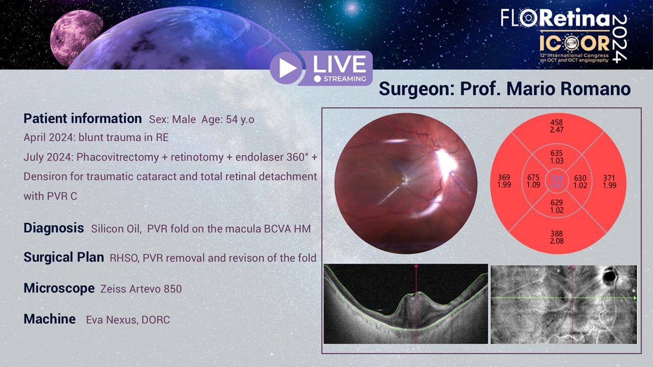 Trauma, total retinal detachment