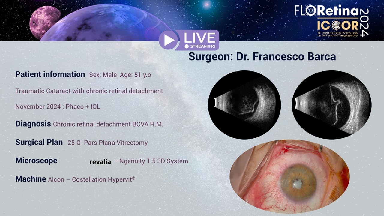 Chronic retinal detachment