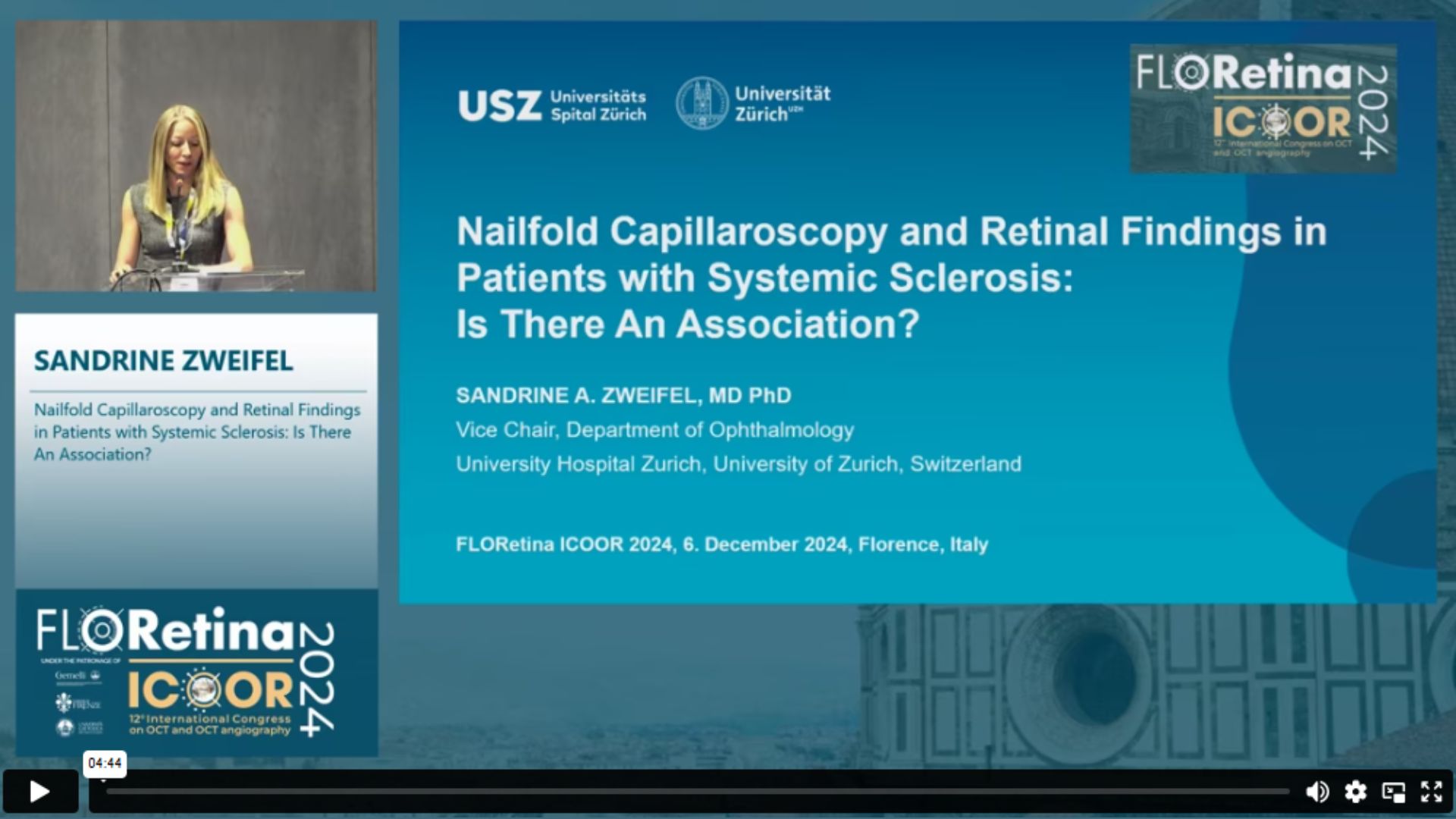 Nailfold Capillaroscopy and Retinal Findings in Patients with Systemic Sclerosis: Is There An Association?