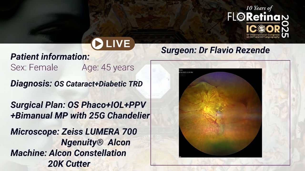 Cataract and diabetic TRD