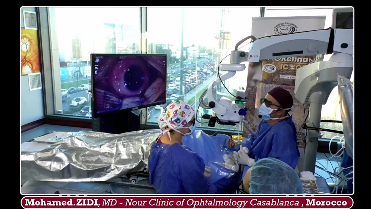 Retinal proliferative membrane and retinal detachment