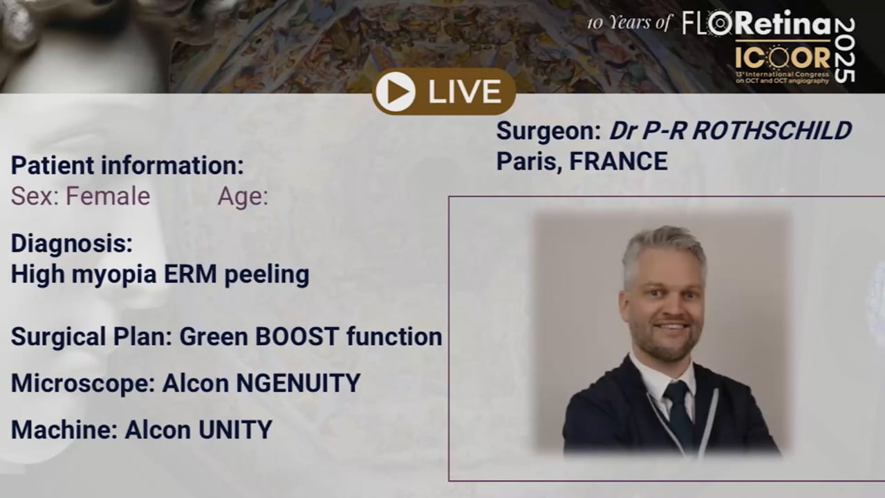 High myopia ERM peeling