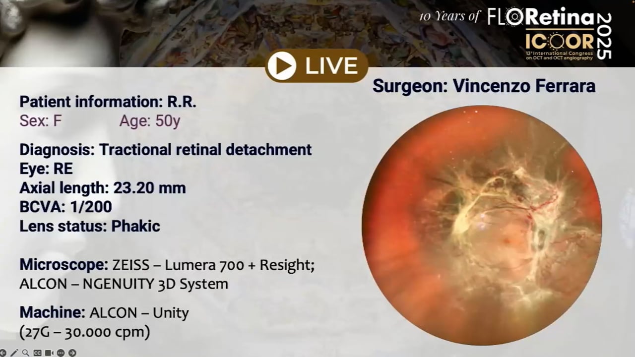 Tractional retinal detachment