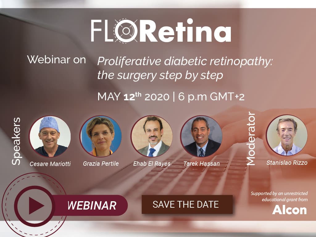 Proliferative diabetic retinopathy: the surgery step by step