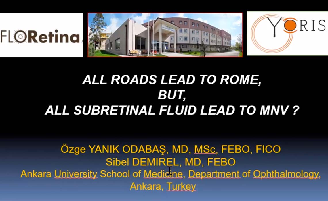 All roads lead to Rome, but, all subretinal fluid lead to MNV?
