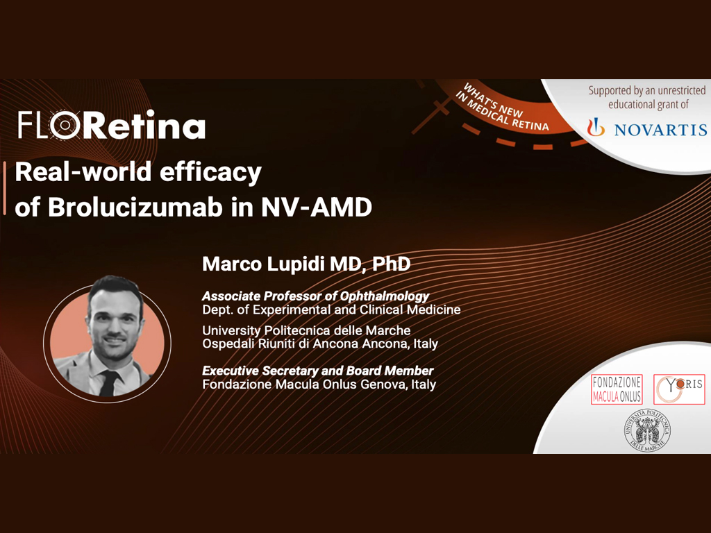 Real-world efficacy of Brolucizumab in NV-AMD 