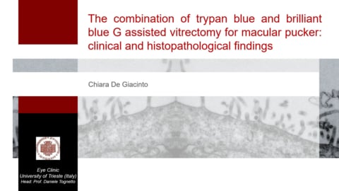 The combination of trypan blue and brilliant blue G assisted vitrectomy for macular pucker: clinical and histopathological findings